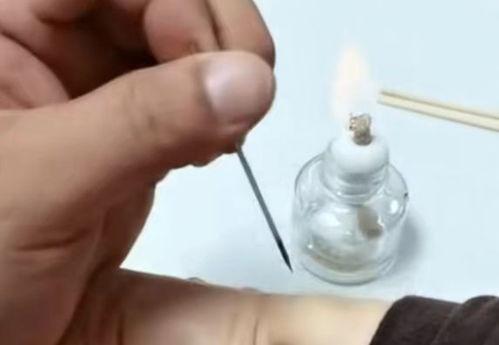 火针视频,传统中医的神秘疗愈之道