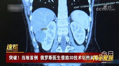 肿瘤视频,揭示癌症奥秘与治疗进展