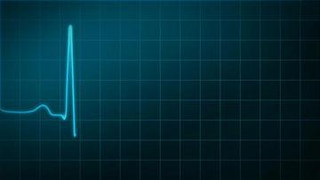 心电图视频,捕捉心脏跳动背后的秘密