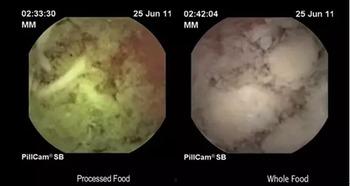 消化视频,视频揭秘人体消化系统工作原理