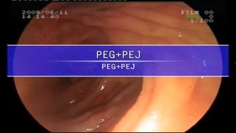 消化视频,视频揭秘人体消化系统工作原理