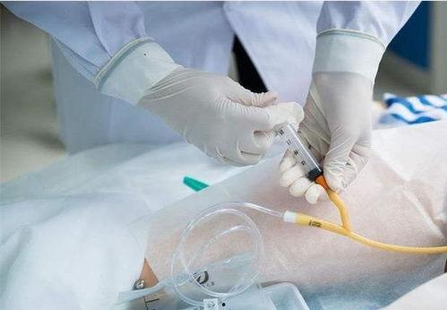 拔尿管视频,直观视频带你了解泌尿健康